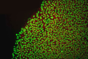 Stem cells to the rescue