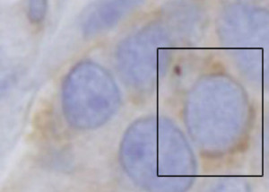 Nucleus protein